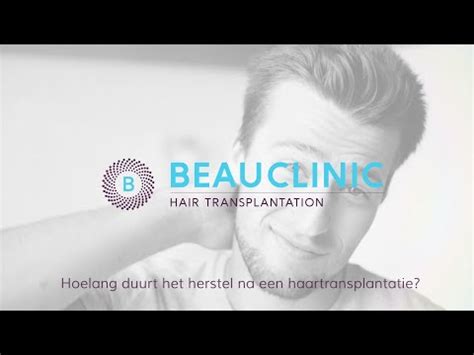 Haartransplantatie Voor En Na: Hoe Lang Duurt Het Herstel?